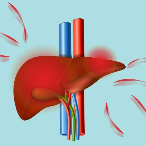 تشخیص بیماری کبد چرب چگونه است؟